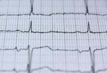 stellar pulse revenue overview