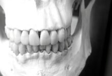 surgical tech study guide overview